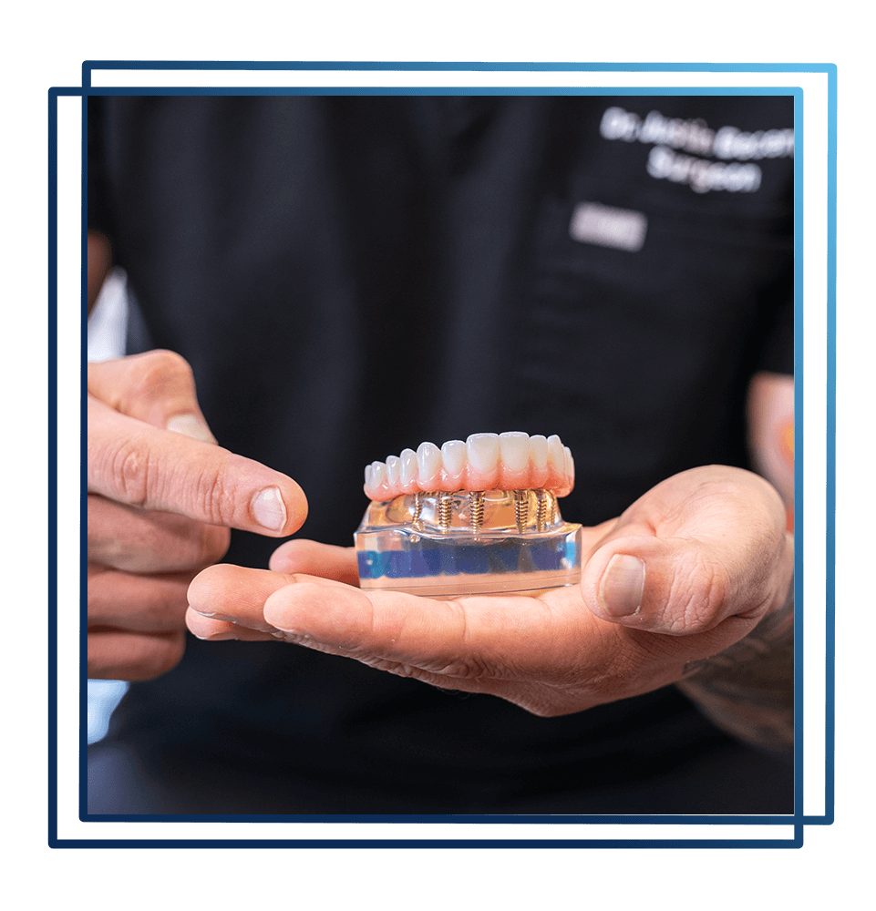 full arch system by touchstone