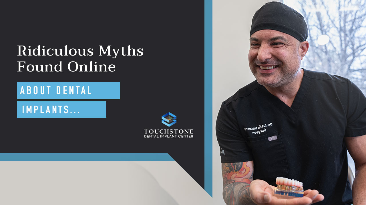 myths for dental implants
