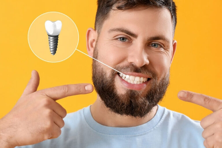 Smiling bearded man pointing to his dental implant with a highlighted graphic overlay, showcasing successful tooth replacement on a vibrant yellow background.